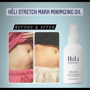 pure romance stretch mark cream